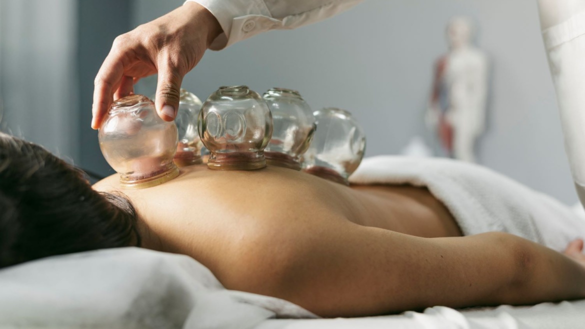 Cupping